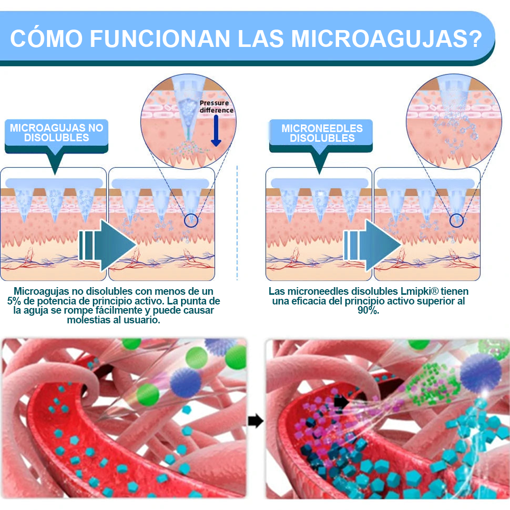 Tienda oficial🍔Lmipki® Parche de Microagujas Nano NIDDK-Tirzepatide✅Aprobado por COFEPRIS (Sin dolor, de larga duración, aborda la diabetes, la obesidad y las enfermedades cardiovasculares)🇲🇽Resultados en 7 días