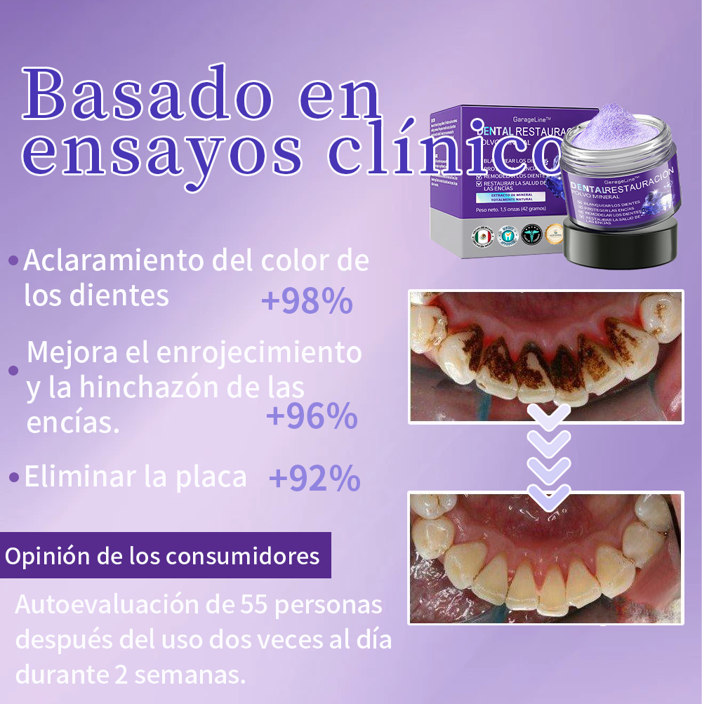 Promoción de último día Disfruta de un 70% de DESCUENTO al agregar un segundo!🔥